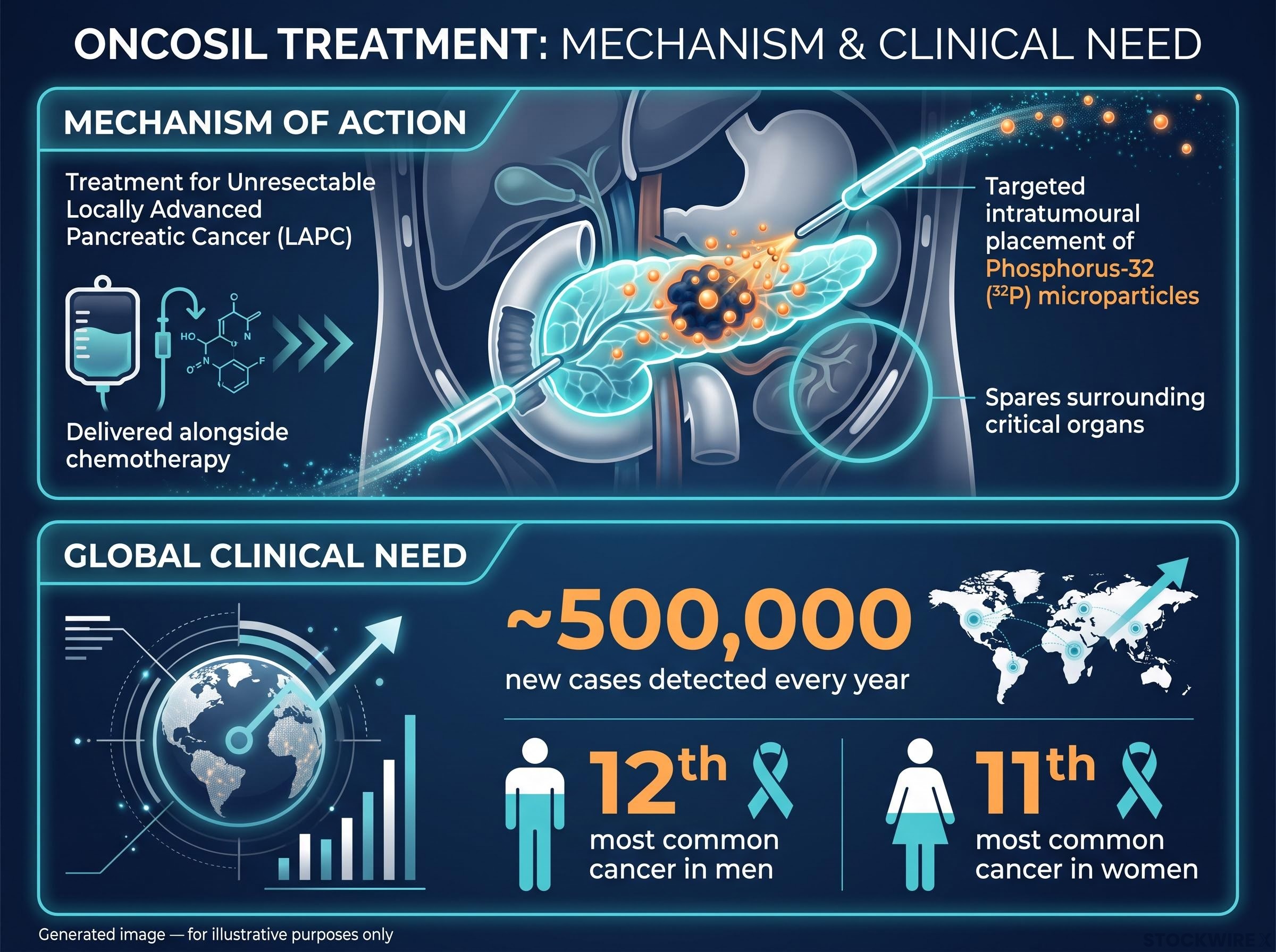 OncoSil™ Mechanism of Action & Clinical Need