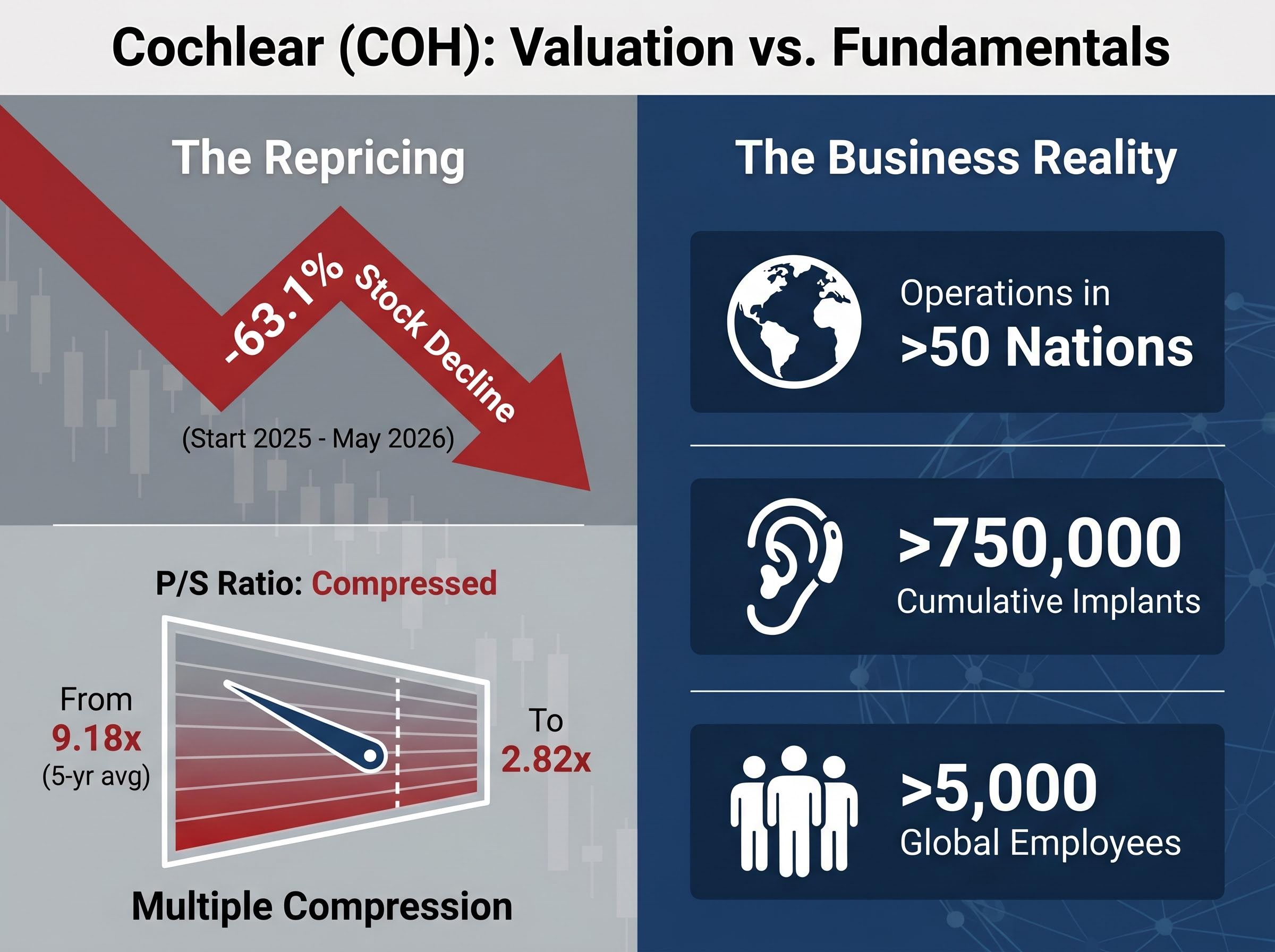 Case Study: Cochlear's Valuation Disconnect